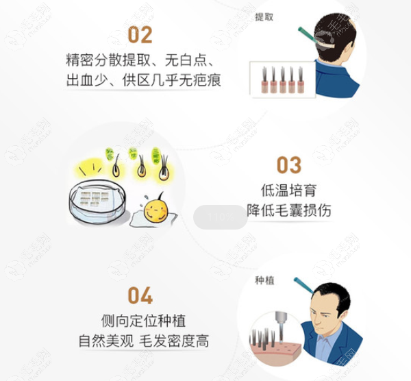 速看UST植发技术是什么意思以及ust微针植发价格