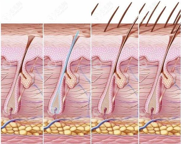 毛囊生长图.jpg