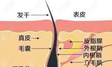 植发后毛囊多久彻底稳固，是七天还是一个月？