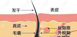 植发后毛囊多久彻底稳固，是七天还是一个月？
