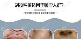 艺术口字胡种植多少钱还附带图片让你看看它的魅力值