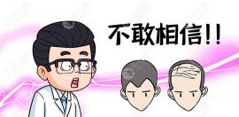 前额植发以后变成小龙人怎么办?m型脱发注意避开这俩坑