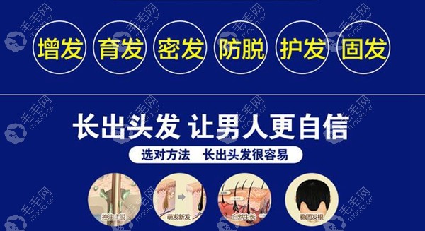 国内目前较好较有效的生发方法是什么?让头发再生真正有4种