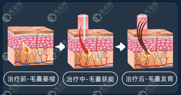 从i黑密生发原理看它怎么样