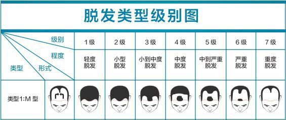 M型脱发的具体表现形式