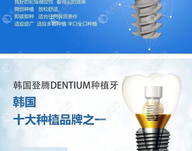 Dentium种植体的螺纹设计