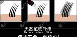 蘇玫氏頭發(fā)纖維粉測(cè)評(píng):看看用增發(fā)纖維會(huì)堵塞毛孔是真的嗎