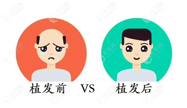 拉萨想要植发的发友看看这几个地方吧