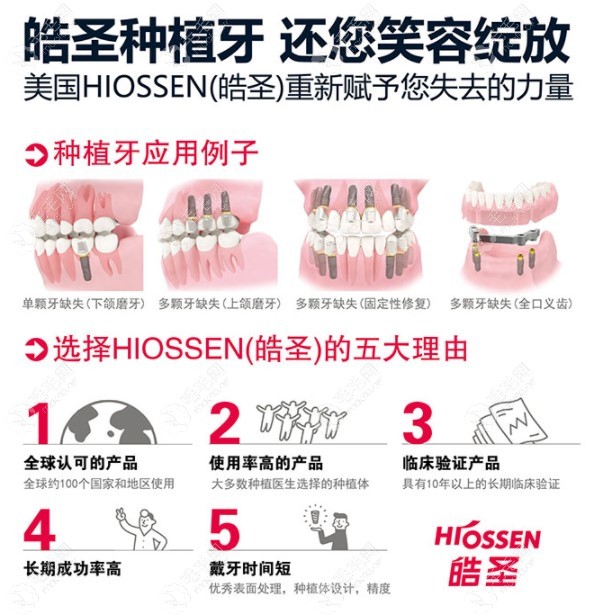 美国皓圣et种植牙系列好不好