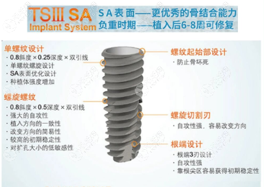 ts和ms的区别