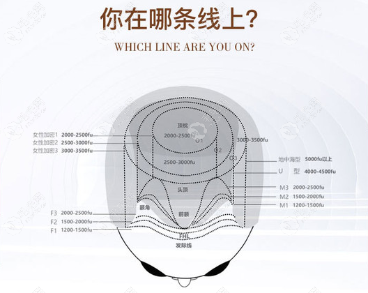 正常植发际线的数量看这张图判断一下吧