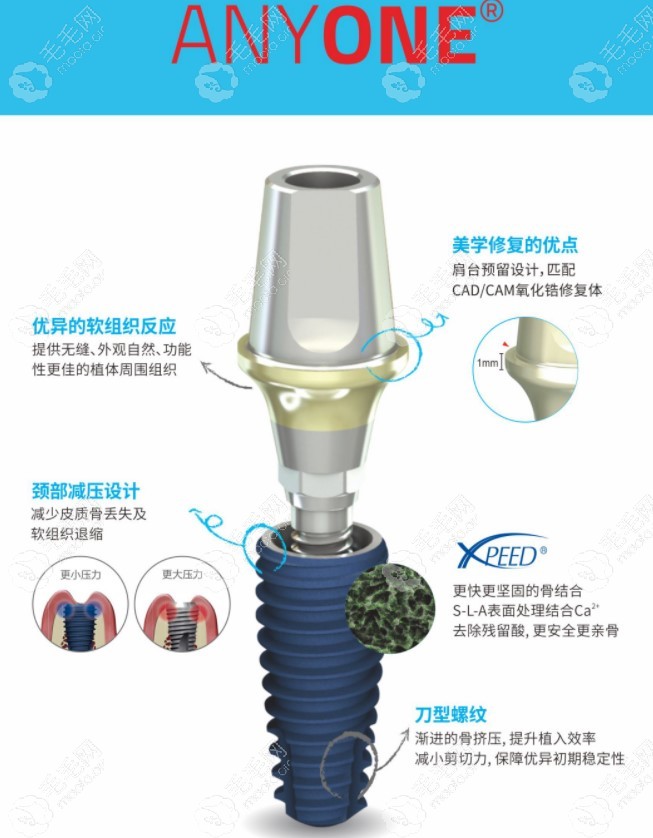 韩国美格真anyone型号