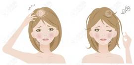 女性脂溢性脫發(fā)怎么治療更有效?不同階段禿發(fā)治療方法不同
