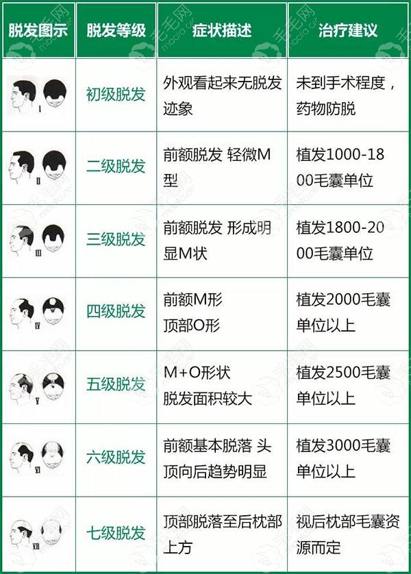 脱发等级图