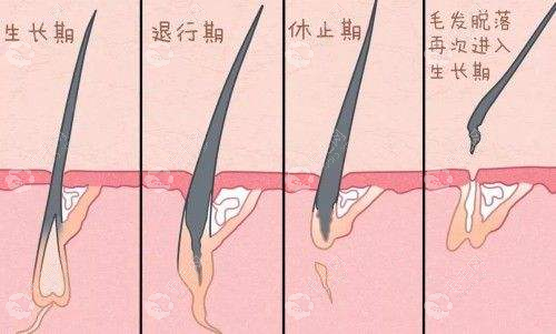 植胡后不管不刮也没问题，它会自己掉哒