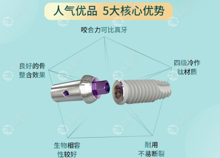 瑞士sic种植体是4级纯钛