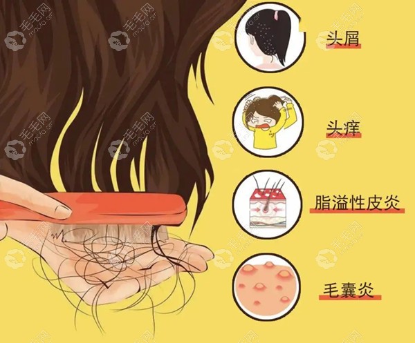 头皮毛囊炎的症状有头屑、头痒等
