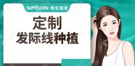 上海植发费用一览,看这做秃顶/发际线植发需要多少钱