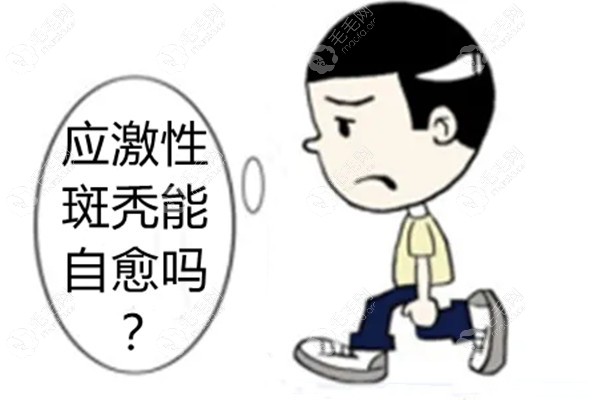 应激性斑秃能自愈吗?这情况会持续多久才能长出来呢