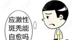 應激性斑禿能自愈嗎?這情況會持續(xù)多久才能長出來呢