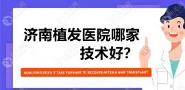 济南植发医院哪家技术好?碧莲盛、海峡、大麦的就还蛮强的