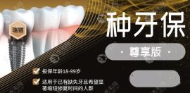 關(guān)于種植牙的保險有哪些?已知的有醫(yī)保/太平/泰康E齒康等7款