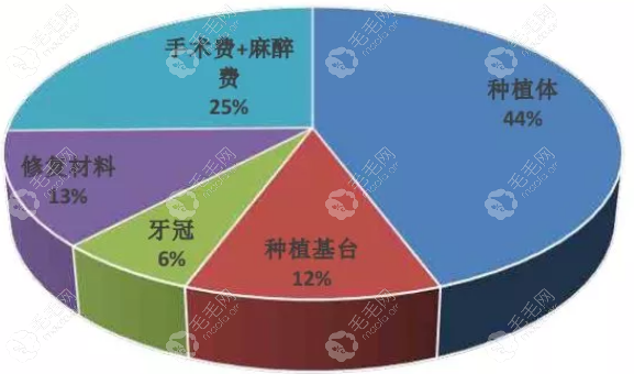 种植牙手术成本拆分