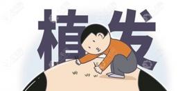 植發(fā)是拆東墻補(bǔ)西墻的原理,只有毛囊壞死的人才適合做哦！