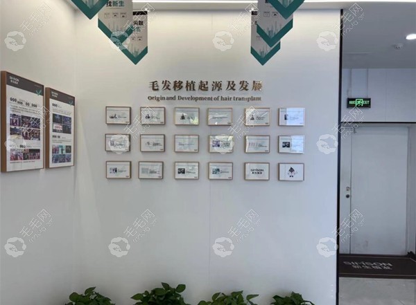 毛发移植起源及发展