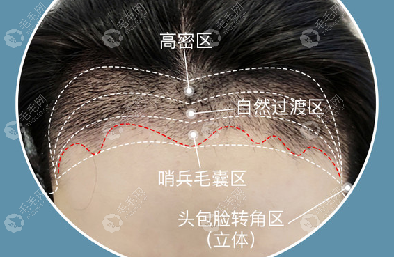 重庆新沐植发过渡非常自然