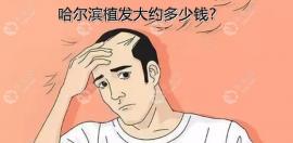 揭:哈尔滨植发大约多少钱?这还有哈尔滨植发4000单位的费用