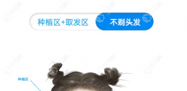 公布不剃发短发植发价格,附首瑞/植发价格表