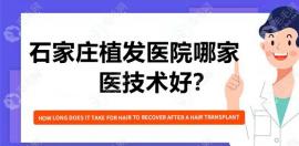 石家庄植发哪家医院技术好?除了碧莲盛还有这些医院..