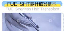 碧莲盛植发价目表公开:全国每个城市碧莲盛植发价格都一样