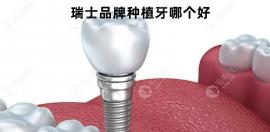 瑞士品牌種植牙哪個好?瑞士iti/拓美/sic價格和壽命比比看