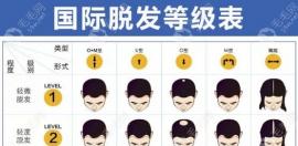  疑问:既然轻度脱发不容易自己恢复,那轻度脱发要怎么改善?