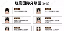 女性彌漫性脫發(fā)怎么治療,結(jié)合彌漫性脫發(fā)1-7級(jí)圖片分級(jí)解說(shuō)