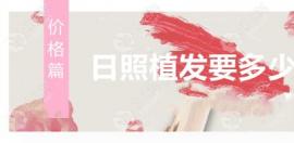 日照植发要多少钱一般?我大概需要植发3000个单位