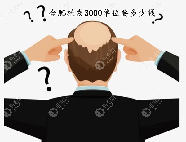 合肥植发3000单位要多少钱,合肥曙光|大麦微针植发价格不同