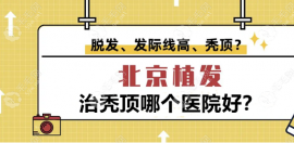 北京治秃顶哪个医院好?治秃顶好的有//大麦...