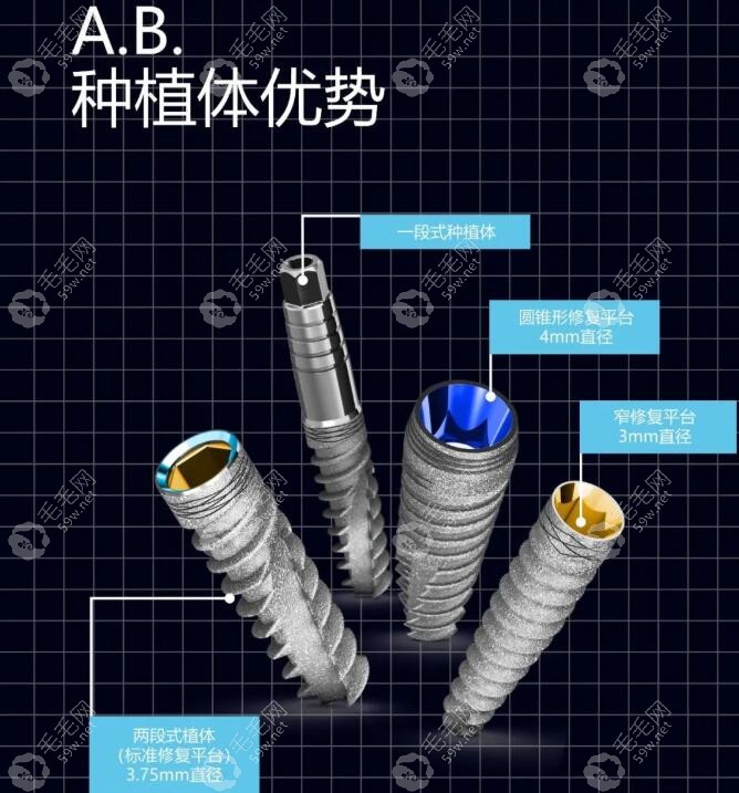 以色列ABT种植体介绍