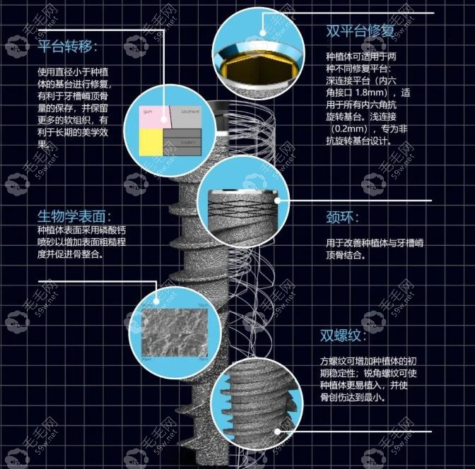 以色列ab种植体的使用寿命是多少年