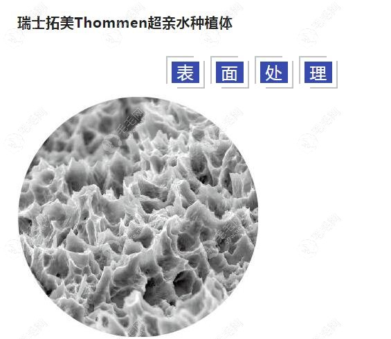瑞士拓美种植体的优势点59w.net