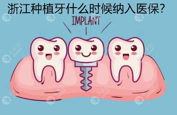 浙江种植牙什么时候纳入医保?杭州/宁波种牙医保政策已上线