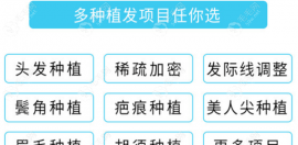 宜春哪里有可以植發(fā)的醫(yī)院,宜春韓美/華美/天澤均可