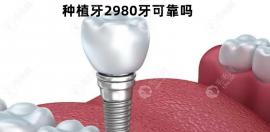 种植牙才2980元靠谱吗？是不是四五千的种植牙质量才可靠？