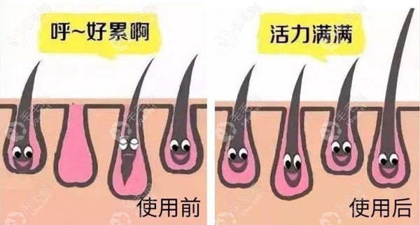 女生发缝宽怎么改善呢