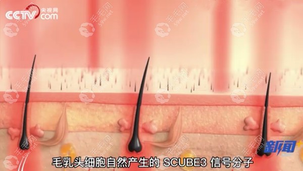 科學(xué)家發(fā)現(xiàn)刺激頭發(fā)生長分子