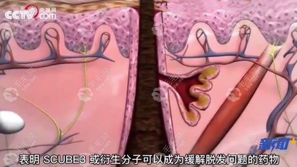 科學(xué)家發(fā)現(xiàn)刺激頭發(fā)生長分子