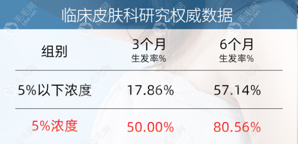 米诺地尔酊女性用2%还是5%